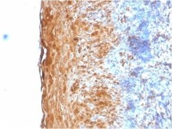 Involucrin Antibody (IVRN/2113R) - Azide and BSA Free, Novus Biologicals 100 &mu;g | Buy Online | Novus Biologicals | Fisher Scientific